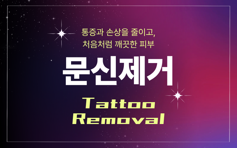 문신 제거