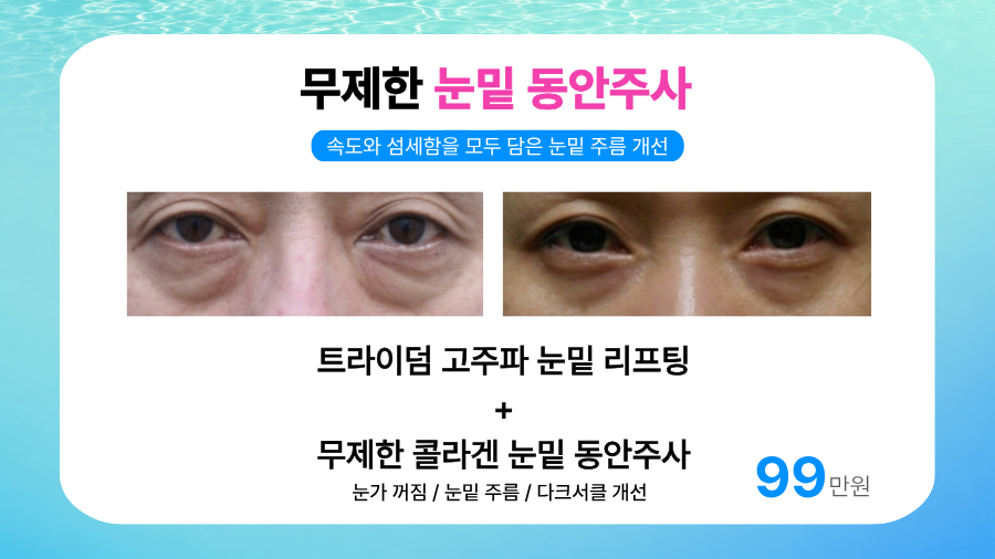랜딩이미지