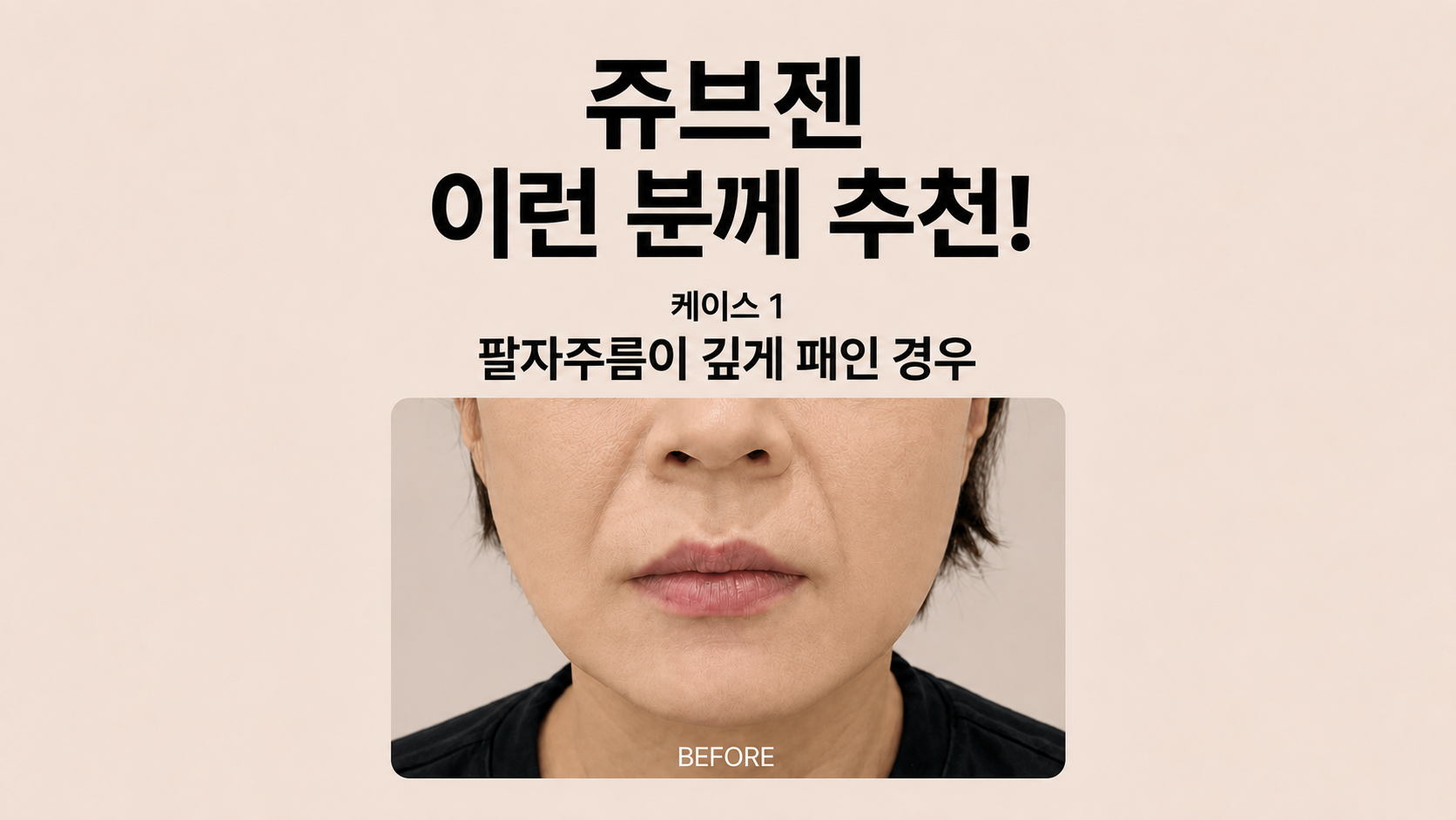 랜딩이미지