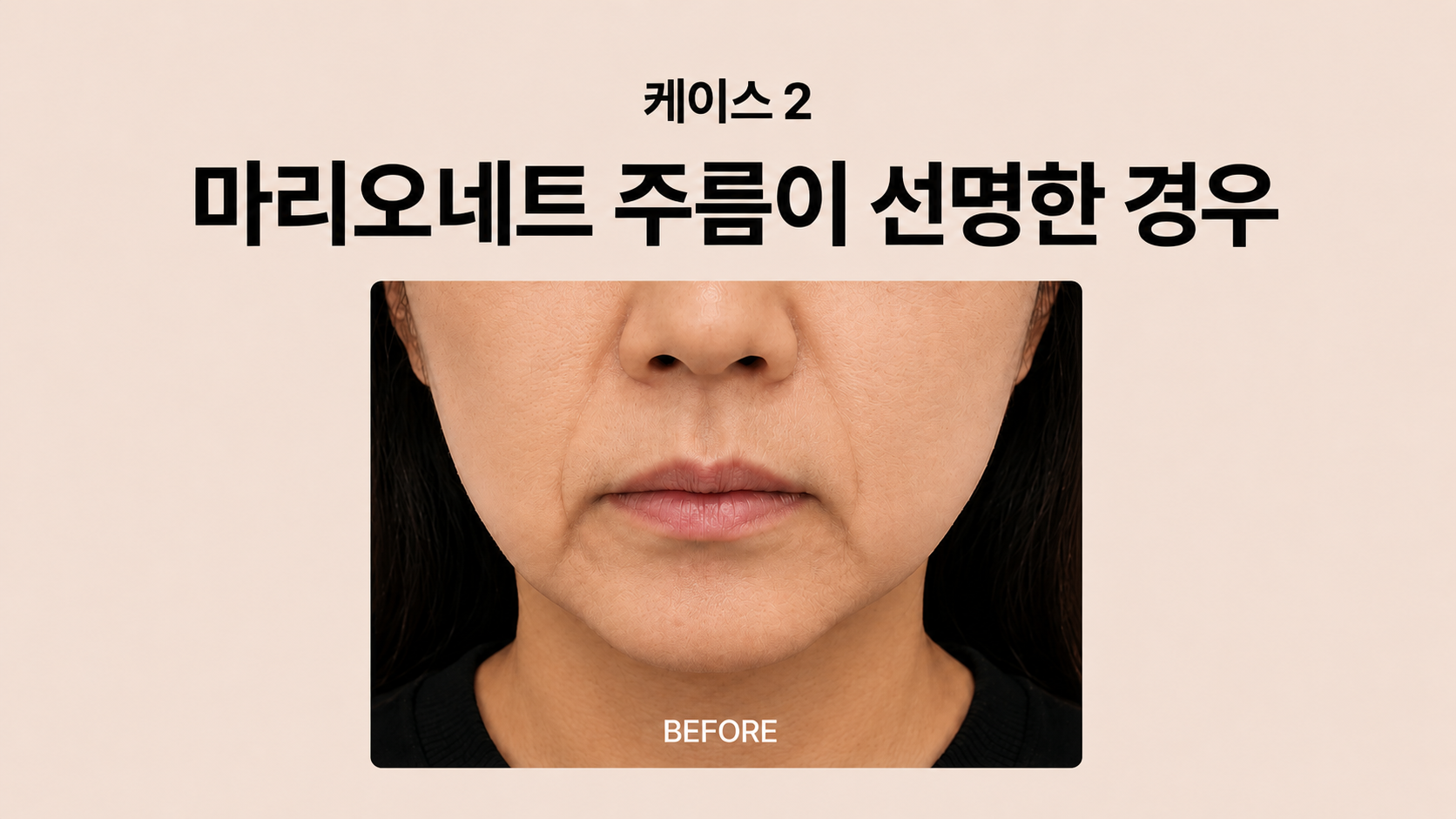 랜딩이미지
