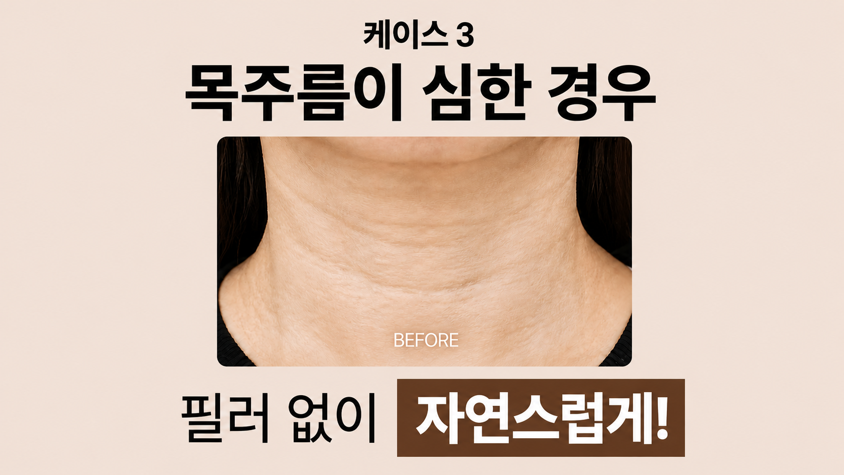 랜딩이미지
