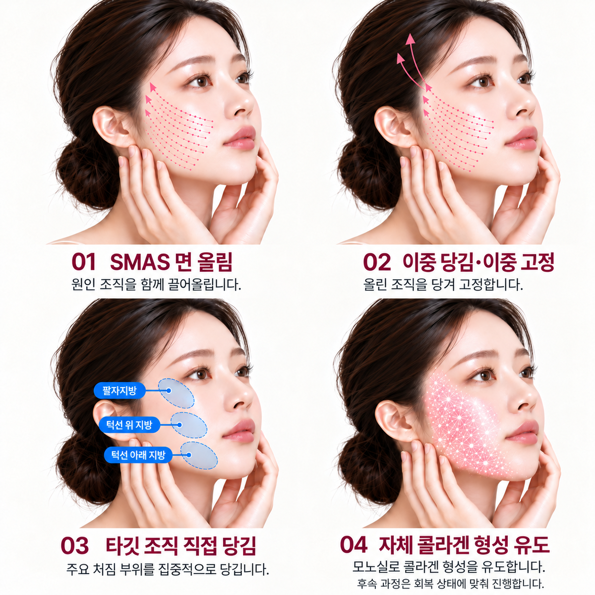 랜딩이미지