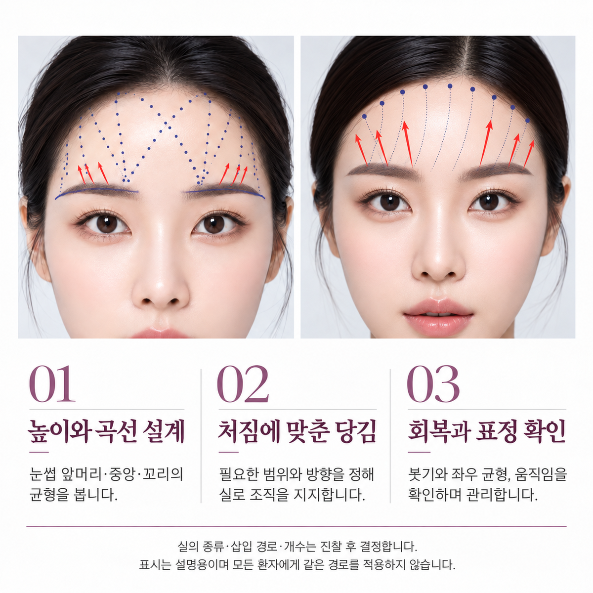 랜딩이미지