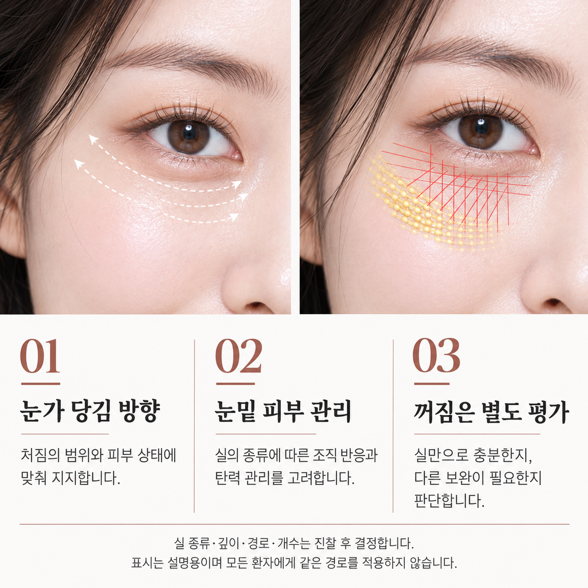랜딩이미지