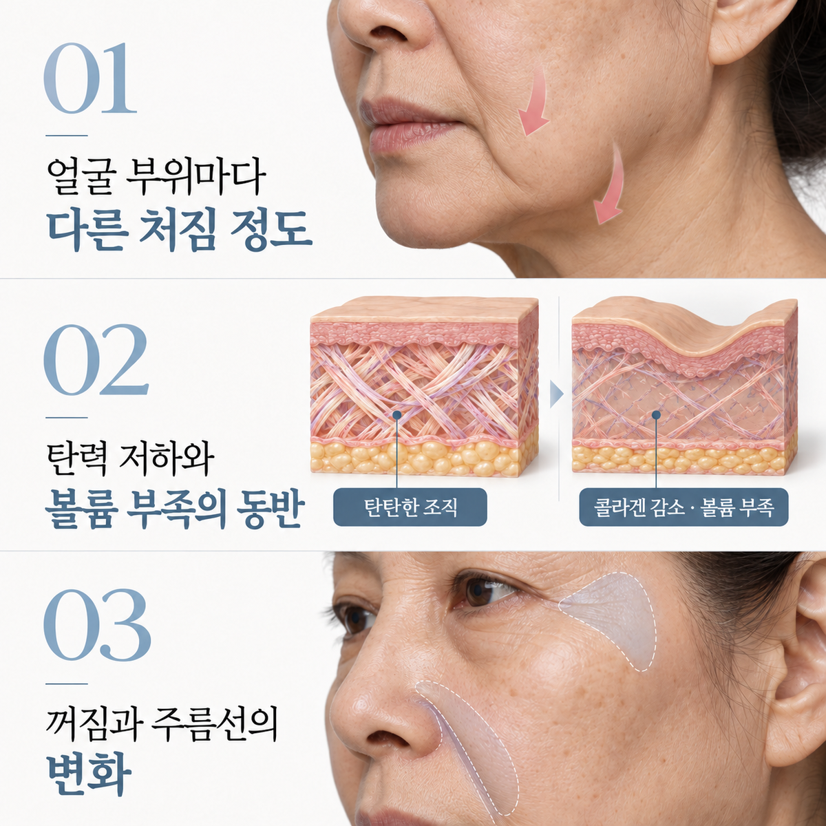 랜딩이미지