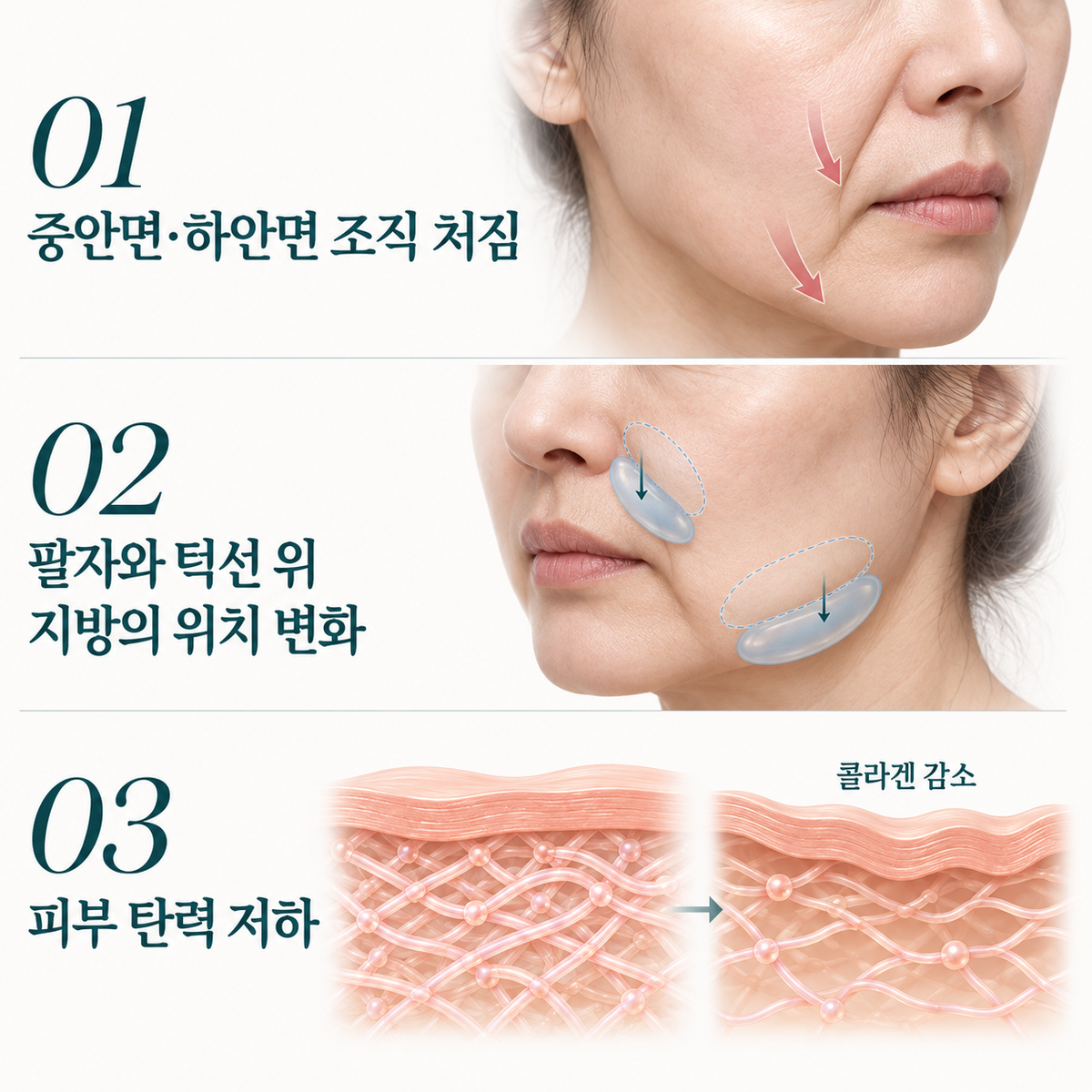 랜딩이미지