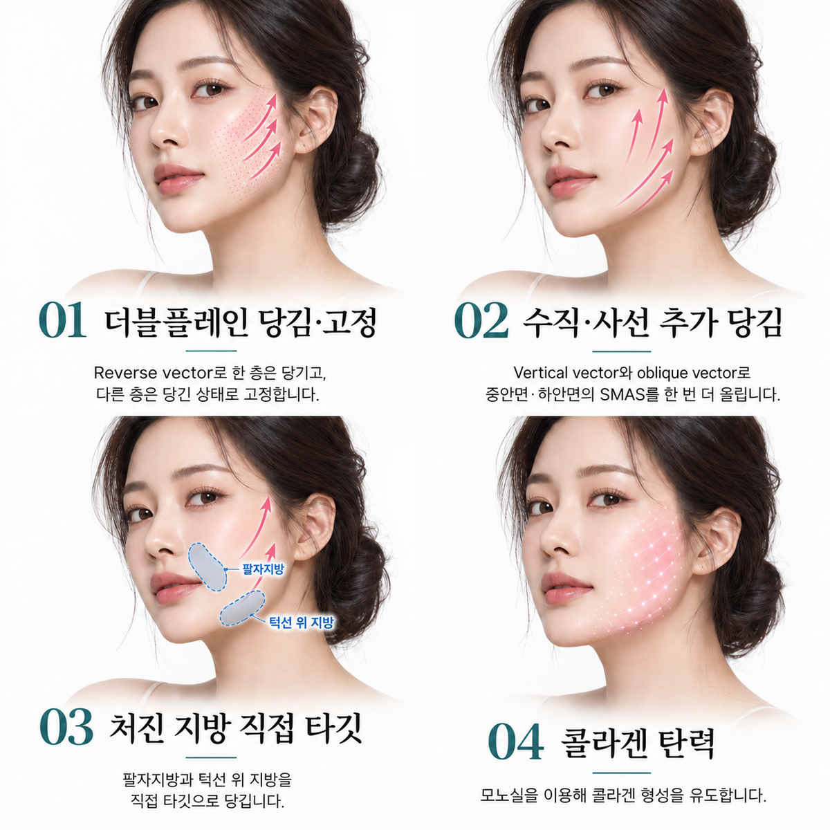 랜딩이미지