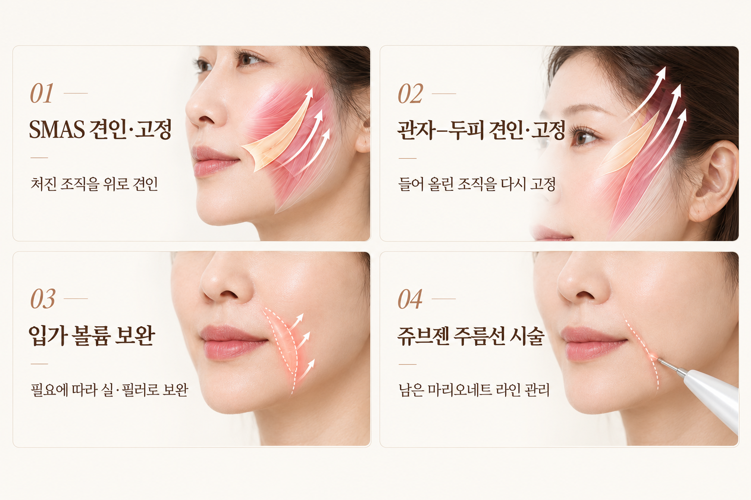 랜딩이미지
