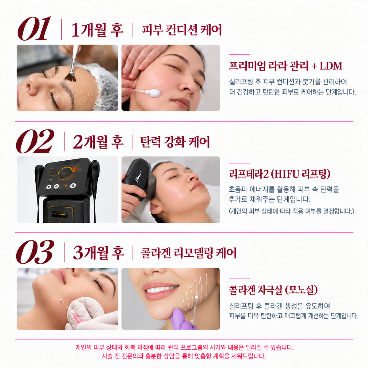 랜딩이미지