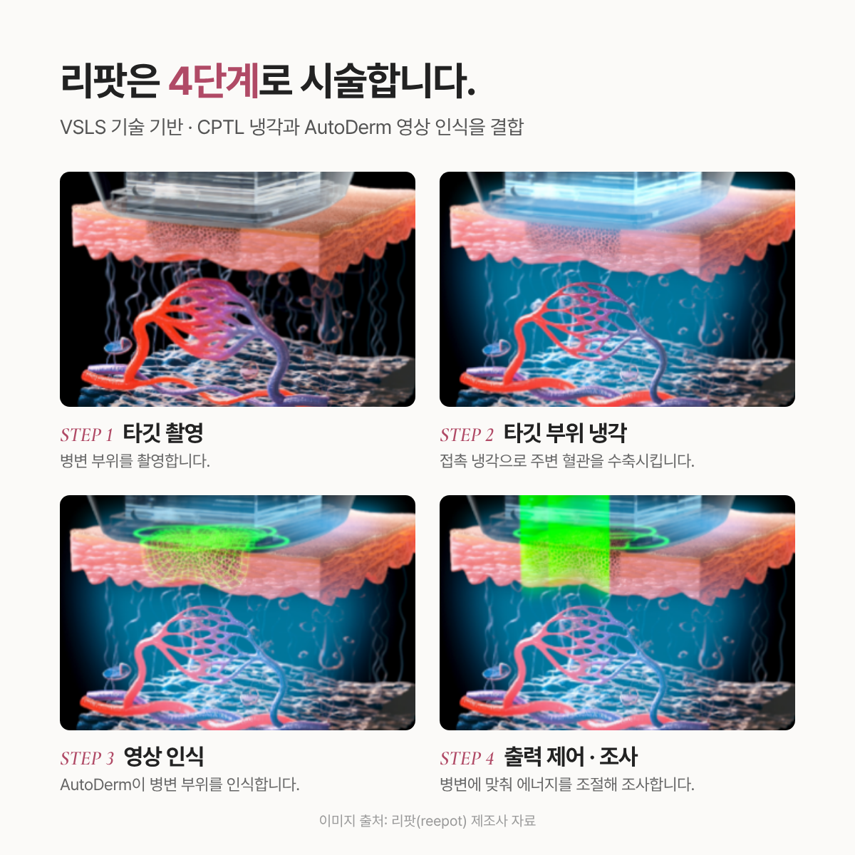 랜딩이미지