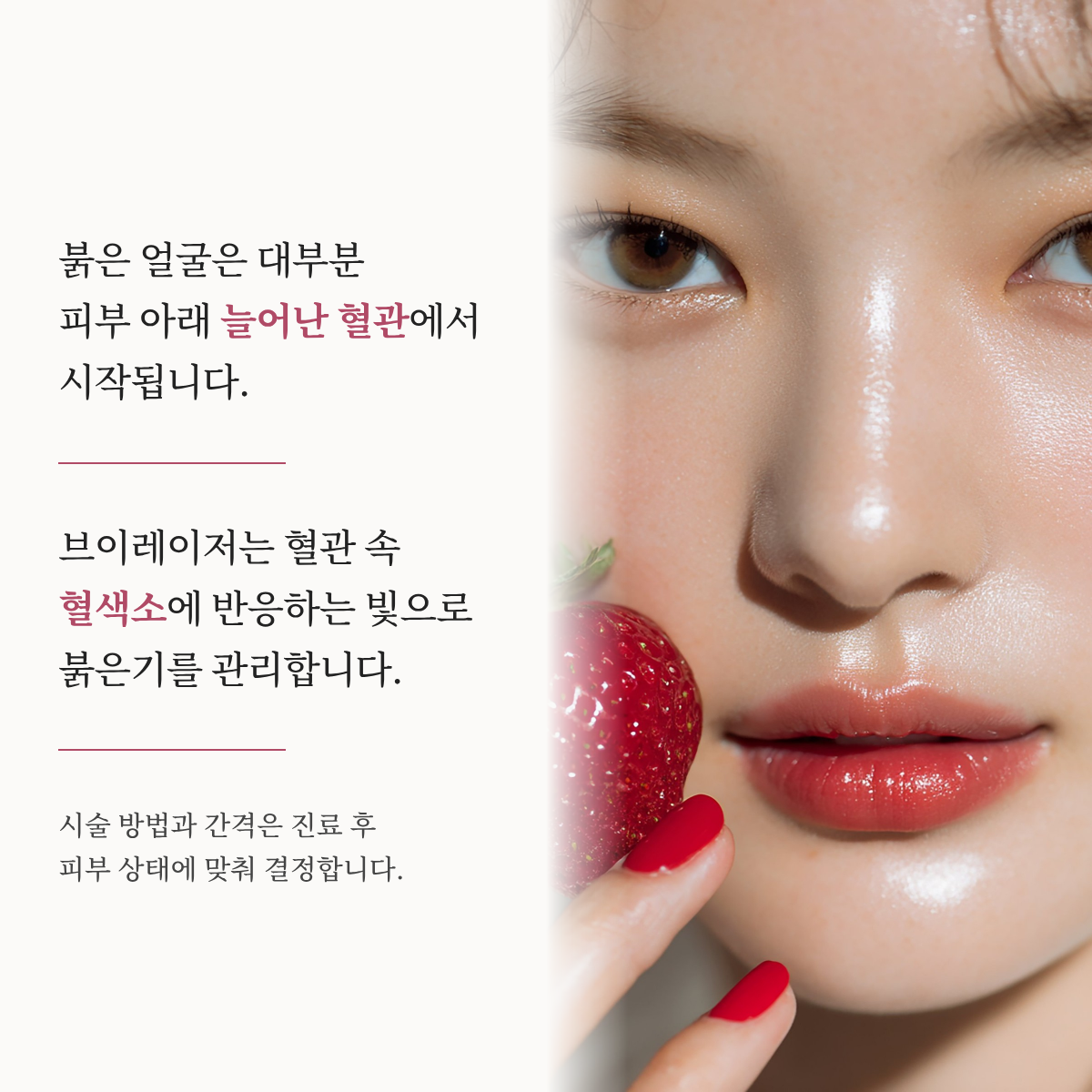 랜딩이미지