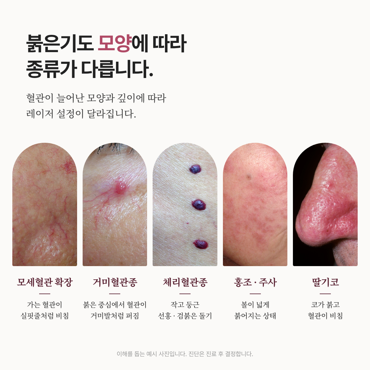 랜딩이미지