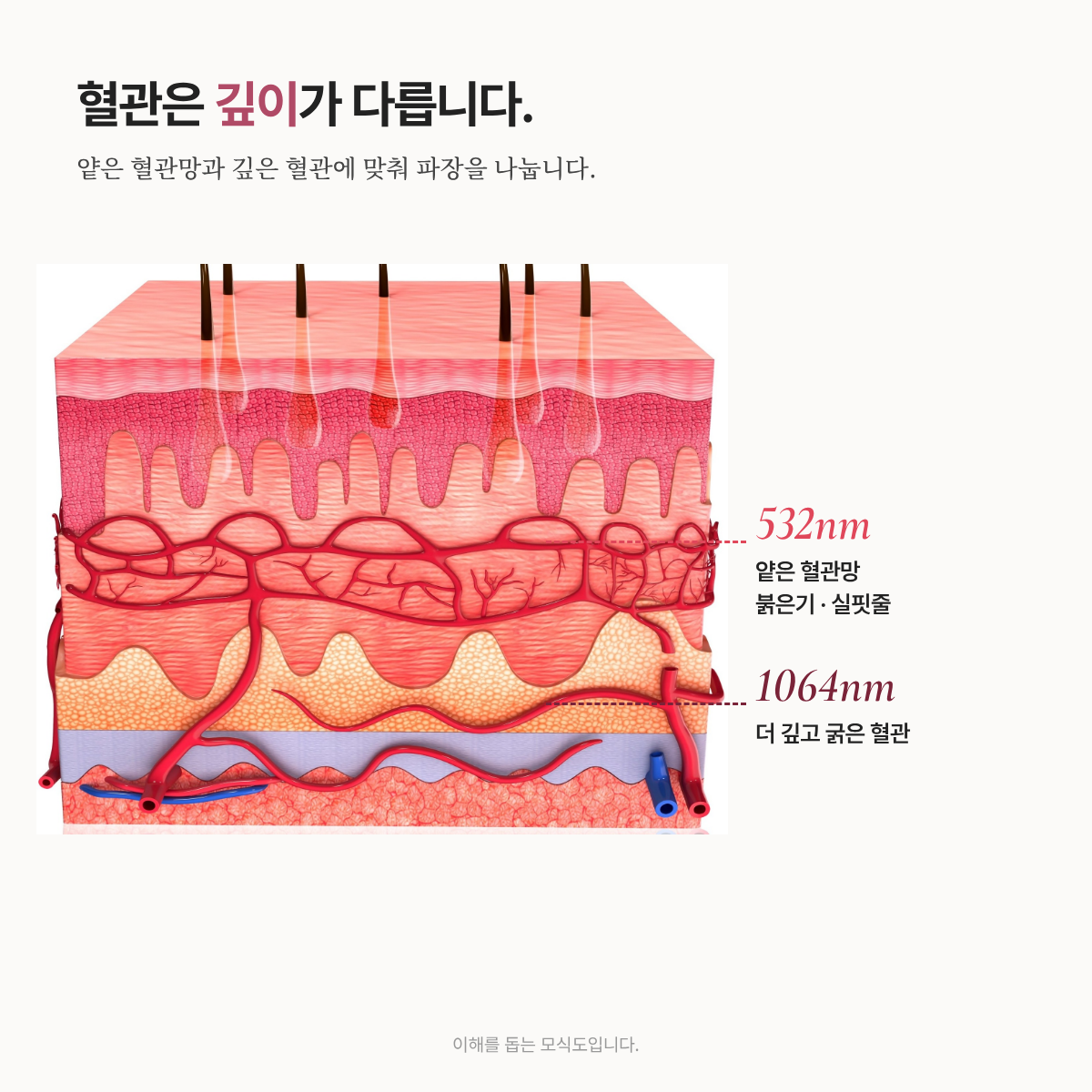 랜딩이미지