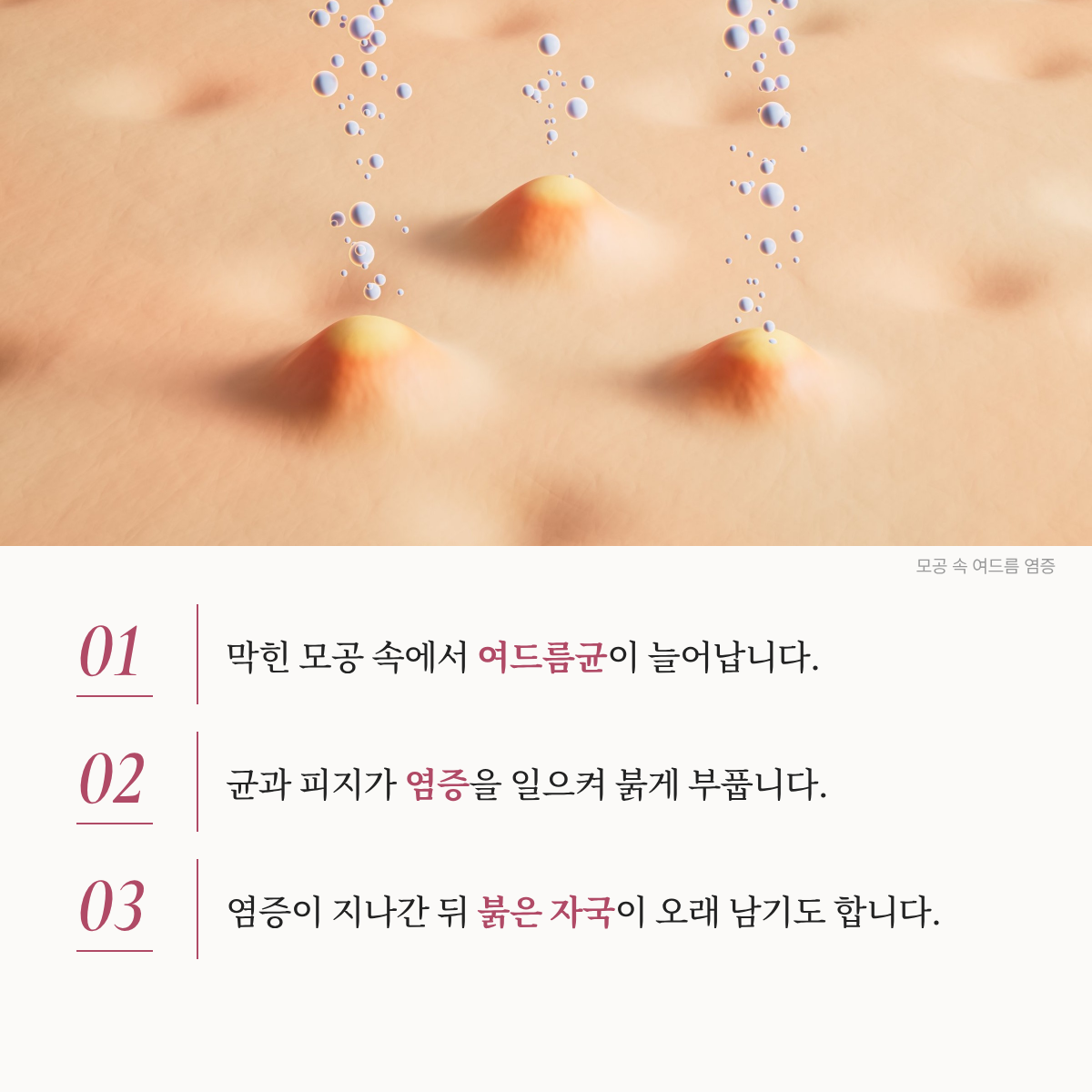 랜딩이미지