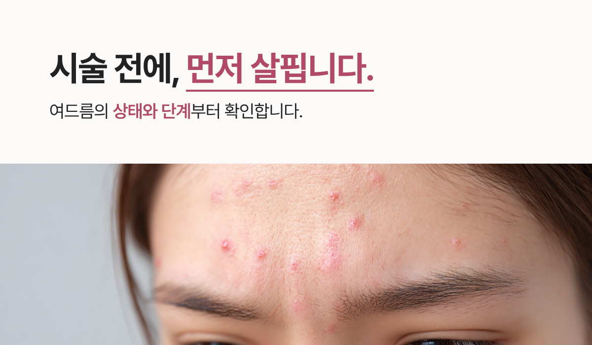 랜딩이미지