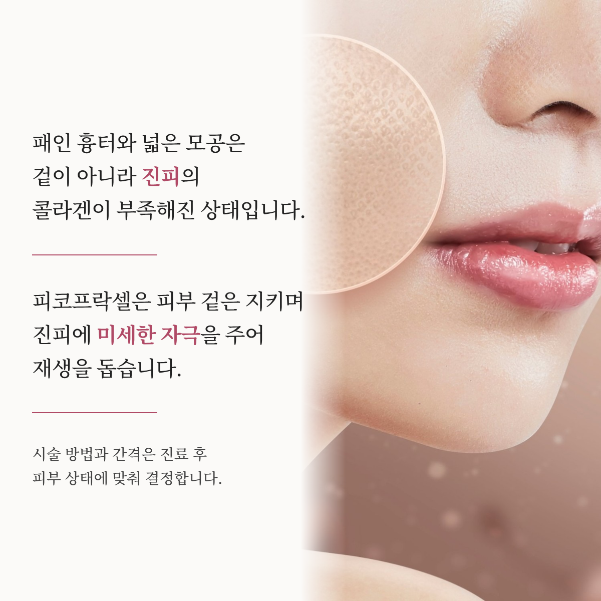 랜딩이미지