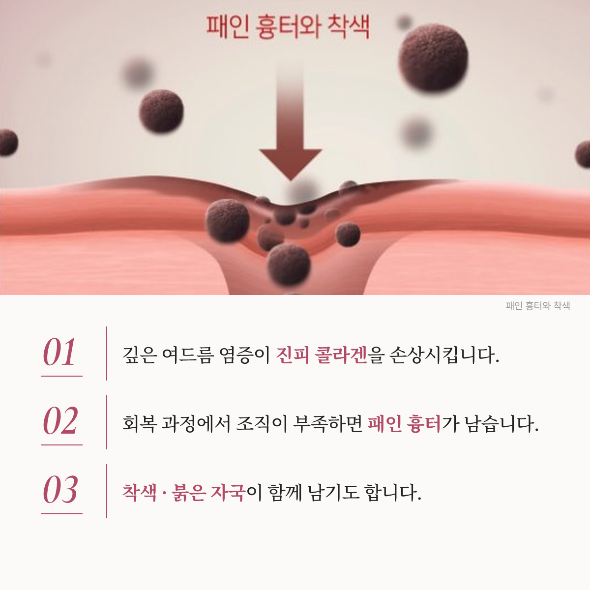 랜딩이미지