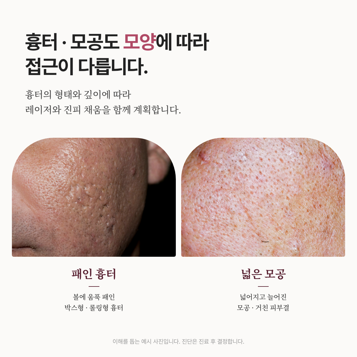 랜딩이미지