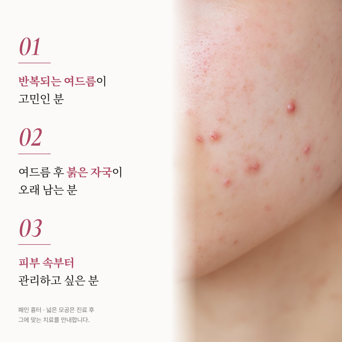 랜딩이미지