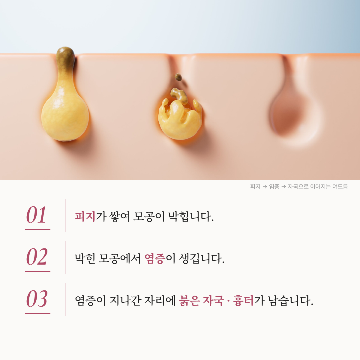 랜딩이미지