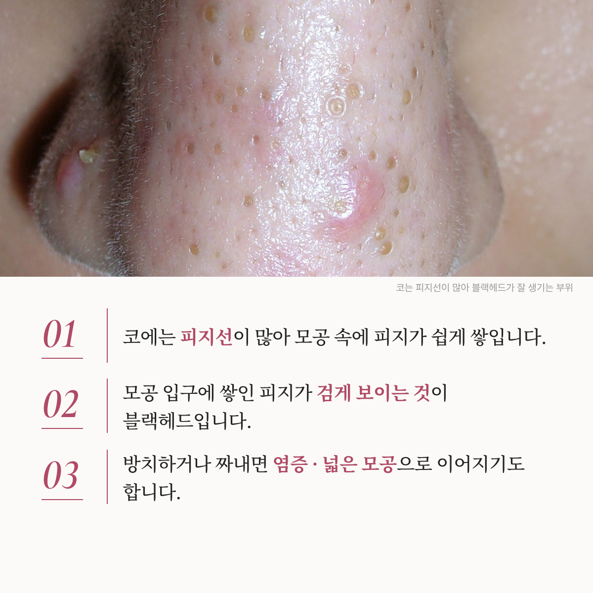 랜딩이미지