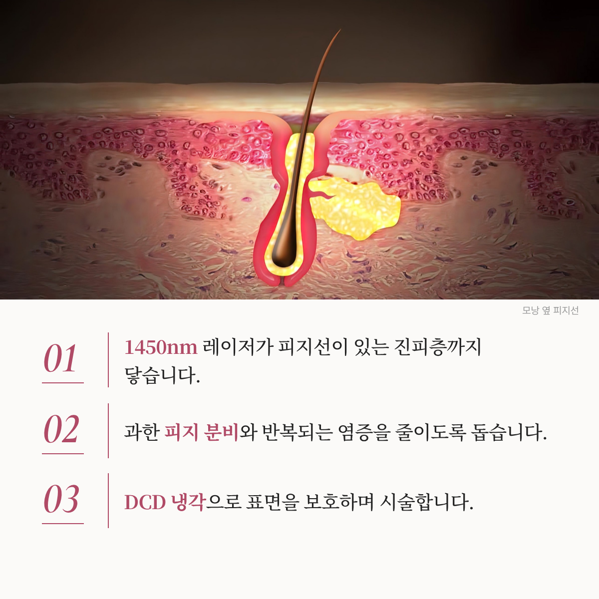랜딩이미지