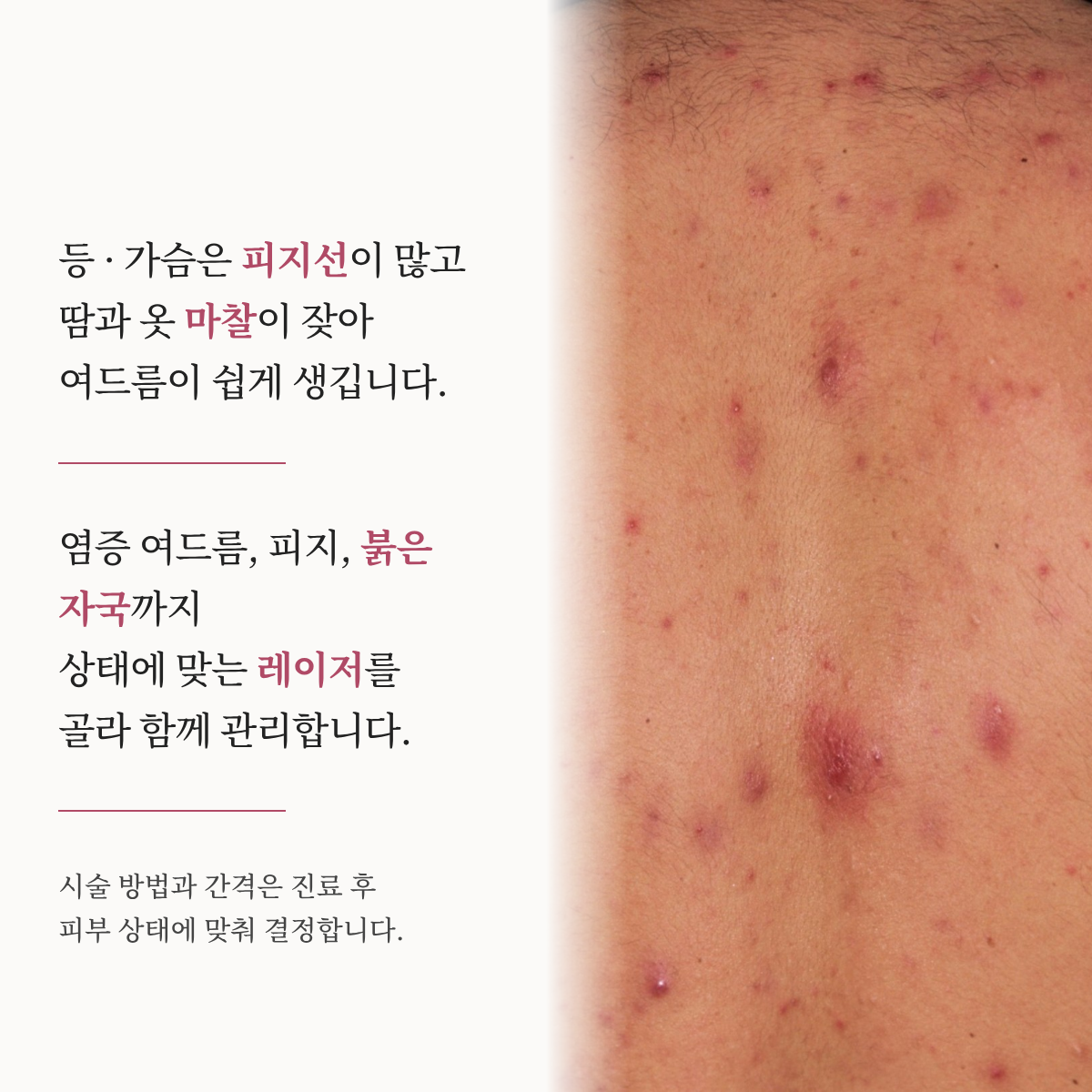랜딩이미지