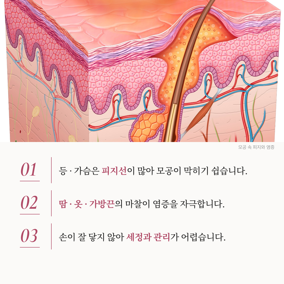 랜딩이미지