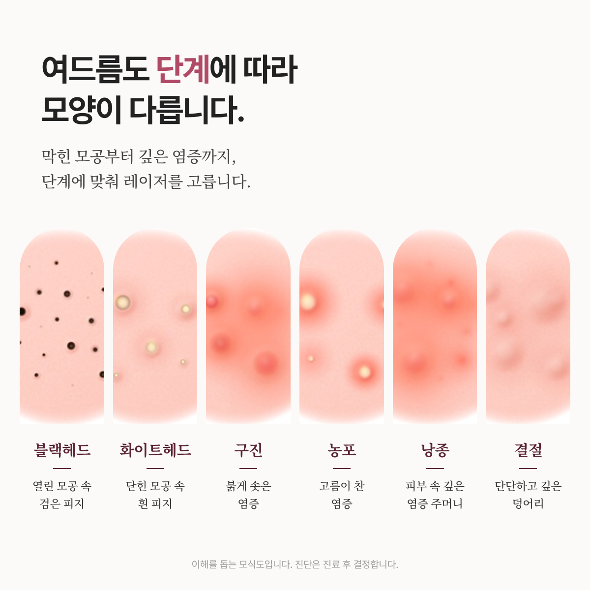 랜딩이미지