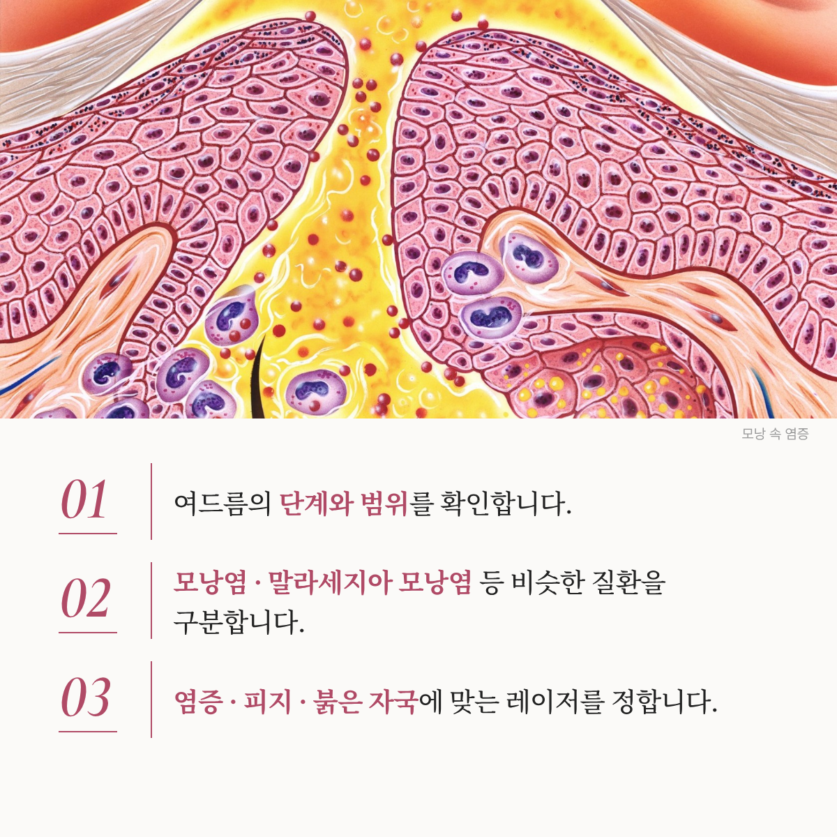 랜딩이미지