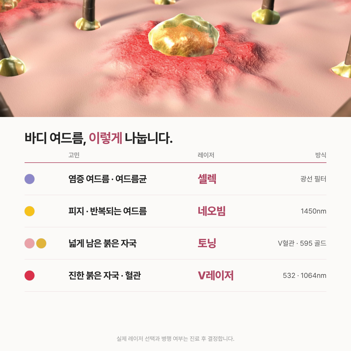 랜딩이미지
