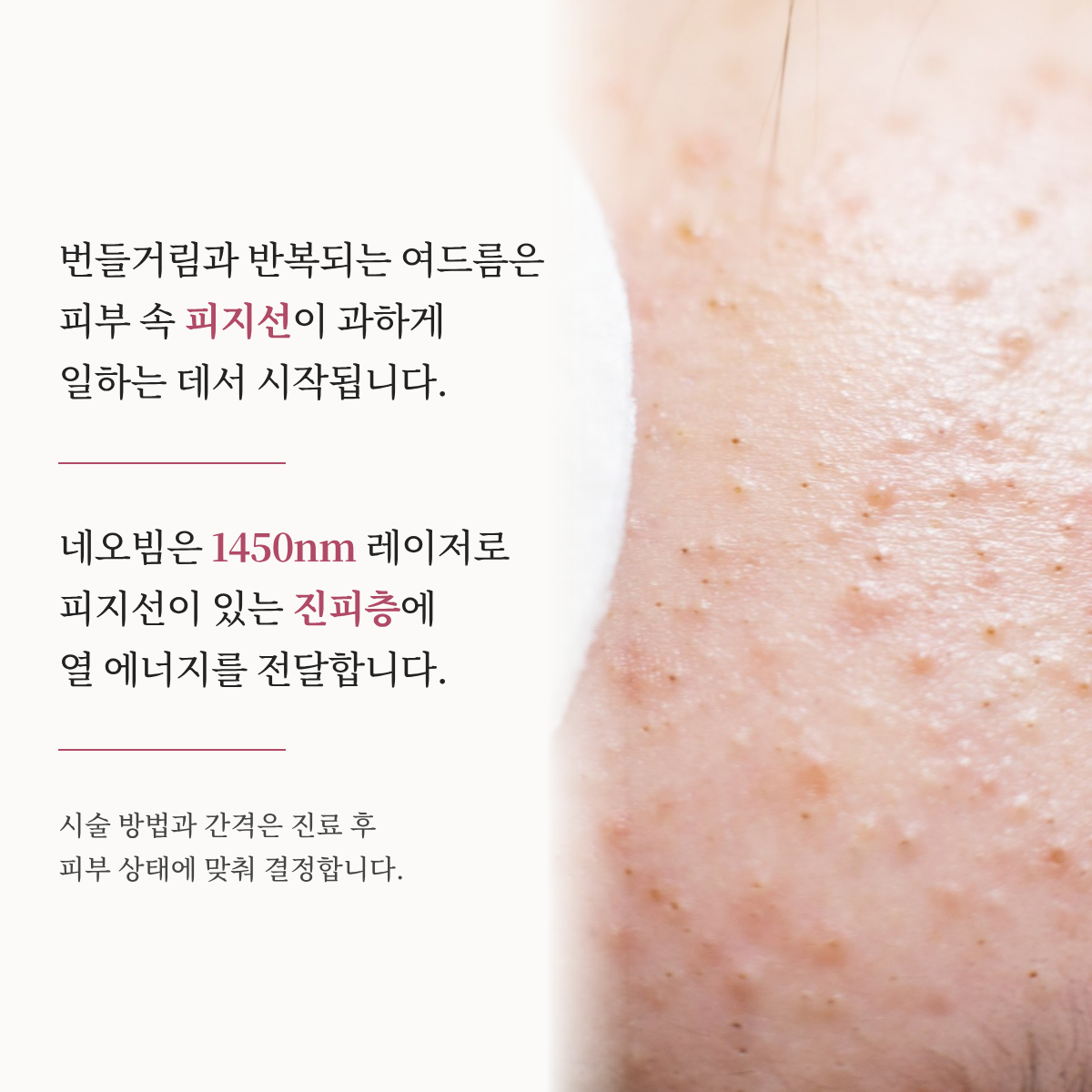 랜딩이미지