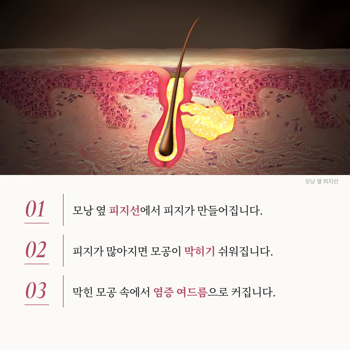 랜딩이미지