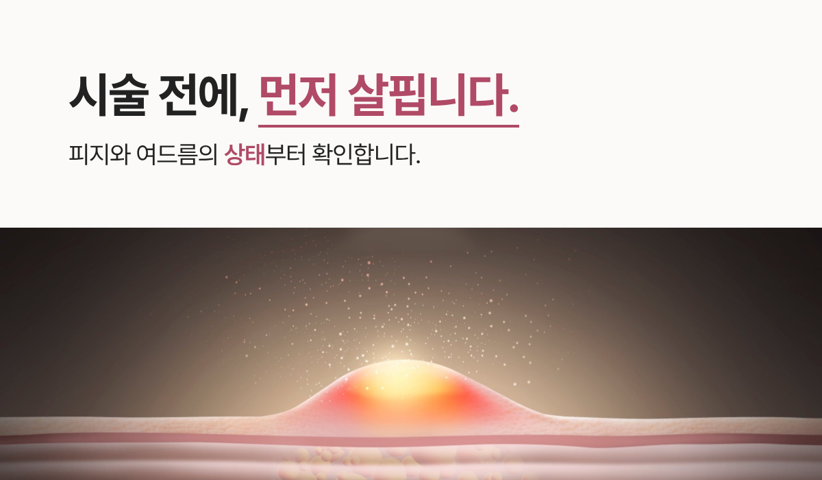 랜딩이미지
