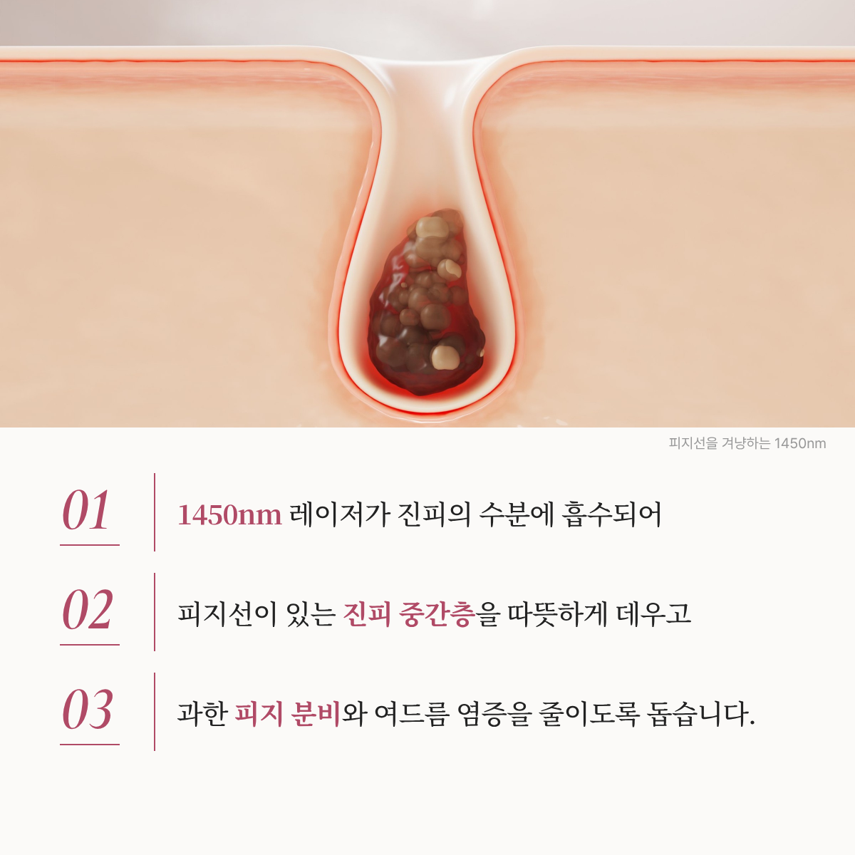 랜딩이미지