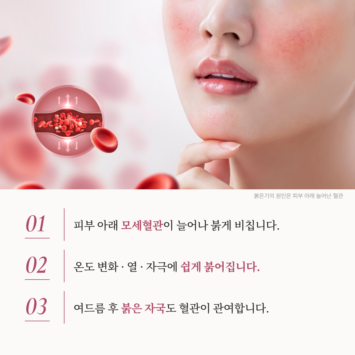 랜딩이미지