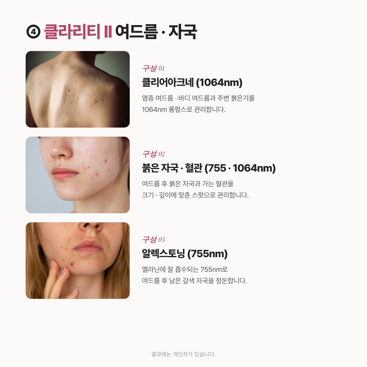 랜딩이미지