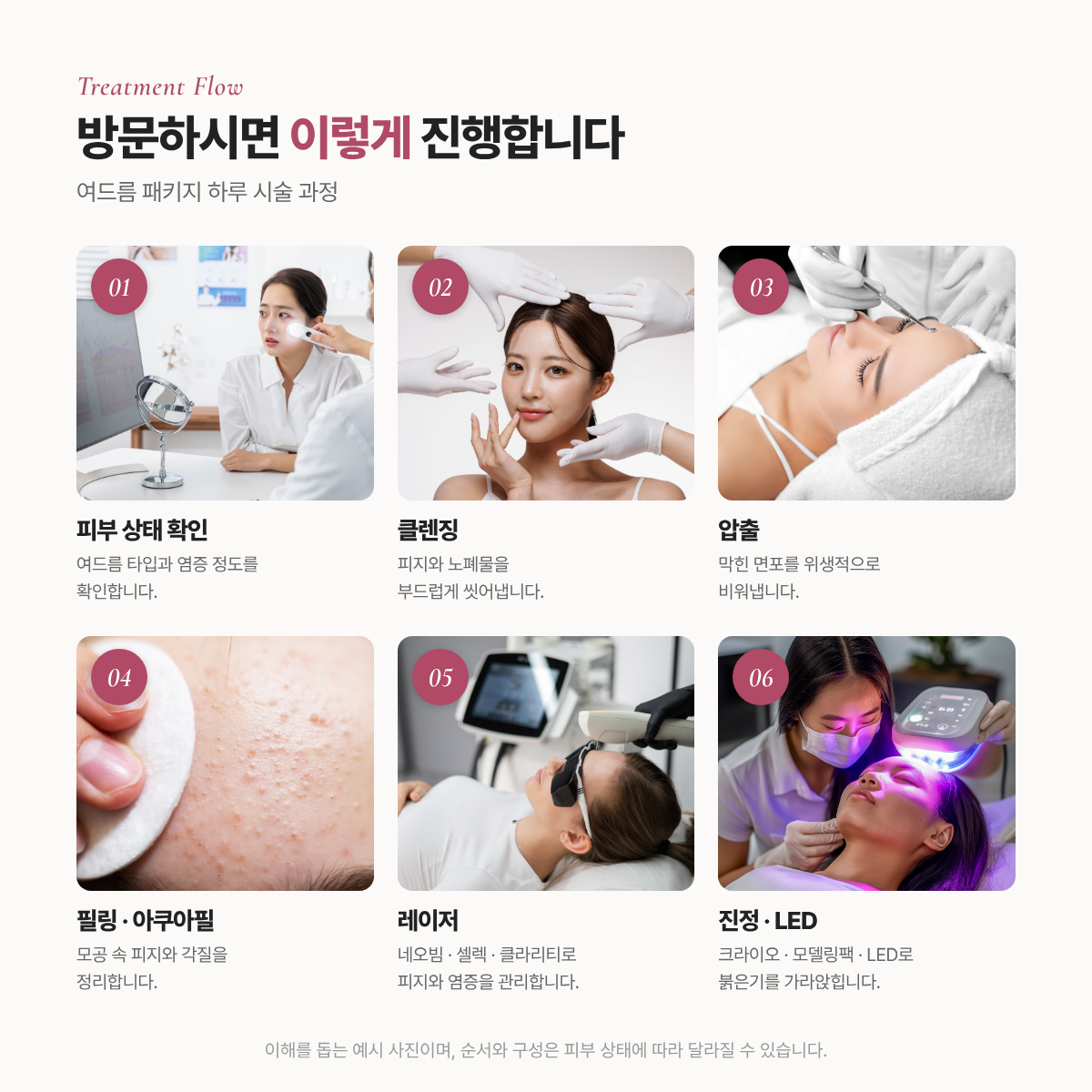 랜딩이미지