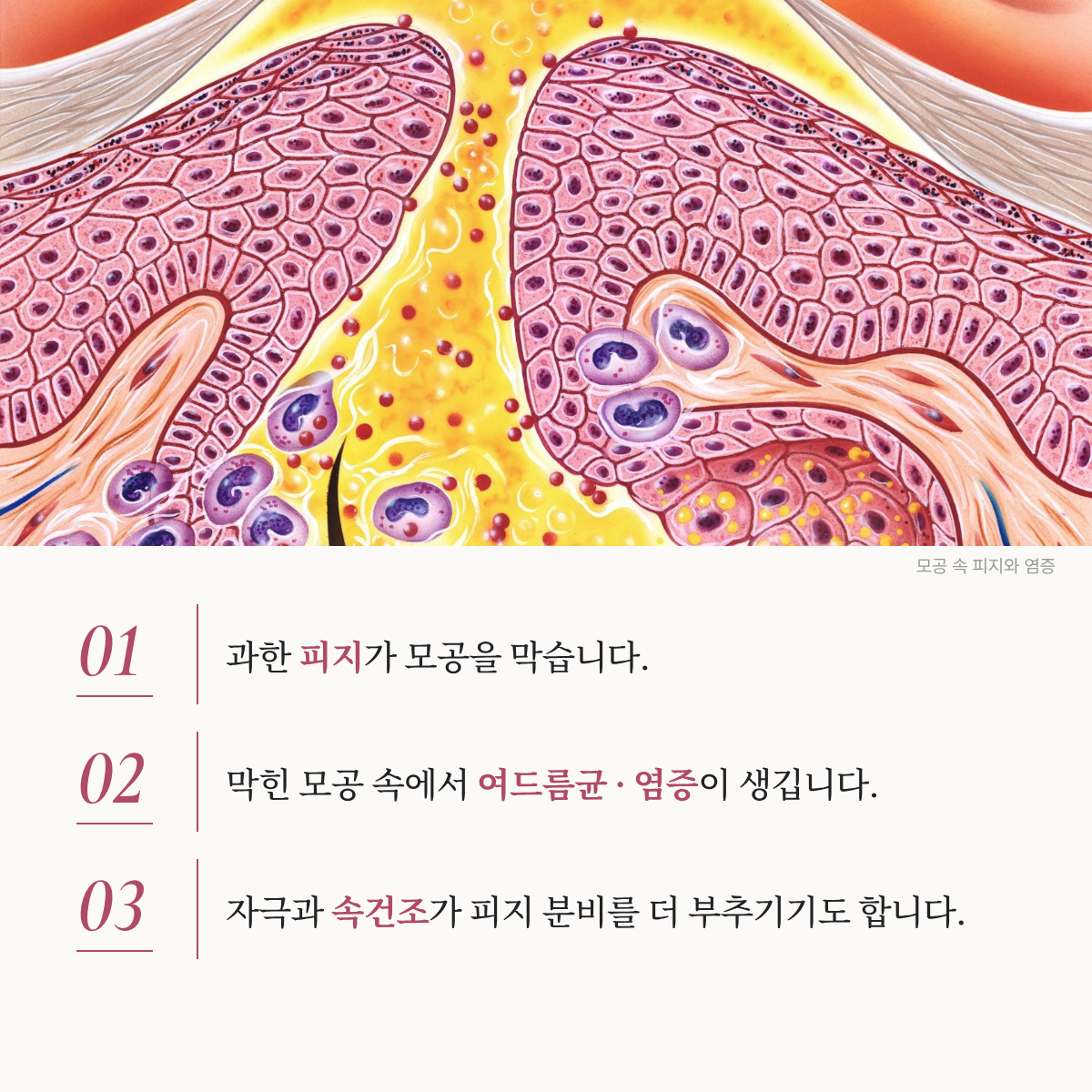 랜딩이미지