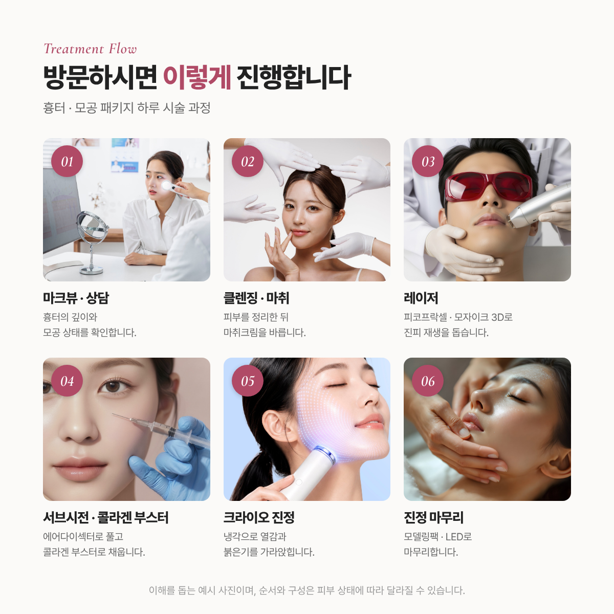 랜딩이미지
