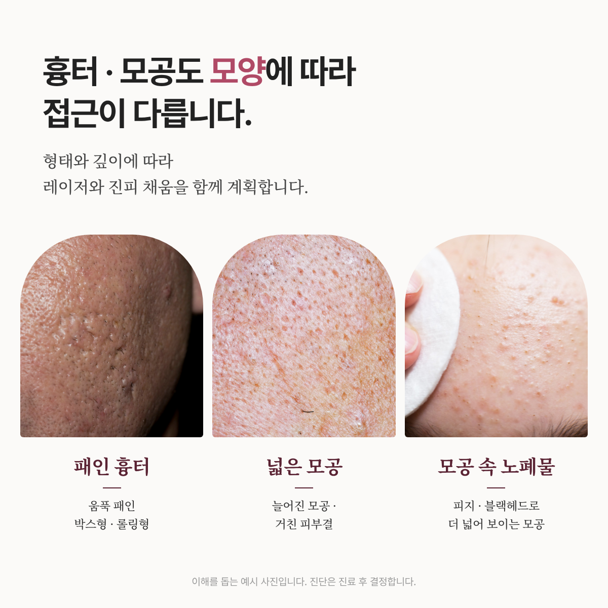 랜딩이미지