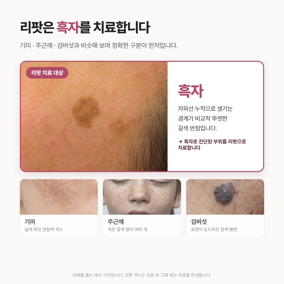 랜딩이미지